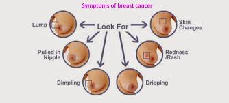 Find out how breast cancer can simply look like a read more. Breast Cancer Symptoms Causes And Prevention Fabwoman