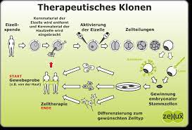 Learn vocabulary, terms and more with flashcards, games and other study tools. Zellux Net Kerntransfer Therapeutisches Klonen