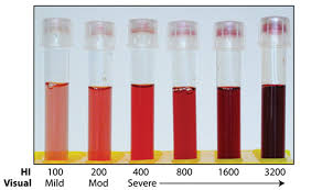 Hemolysis Index Hi Versus Visual Estimates Of Hemolysis