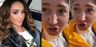 Сегодня давид манукян вышел на связь и развеял общественные домыслы. Sonnaya V Morshinah I Bez Kosmetiki Dava Specialno Pozorit Buzovu Vystavlyaya Problemnye Zony Napokaz