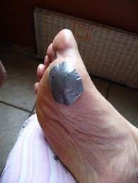 Pin On Home Remedies