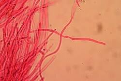Image result for Pycnoporellus alboluteus