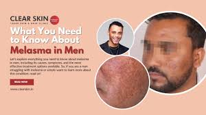 Do Your Hands Give Away Your Age?