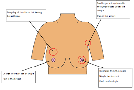 It could also be a sign of more serious conditions, like an infection or breast cancer. Signs And Symptoms Keep Calm Know Your Breasts