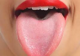 Maybe you would like to learn more about one of these? Lingua Bianca Cause E Rimedi Studio Dentistico Martellago E Mestre Clinica Michielan