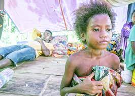 Seorang lelaki orang asli, 30, meninggal dunia di pondok berhampiran lombong bijih aring 11, gua musang. Orang Asli Deaths In Kampung Kuala Koh Due To Pneumonia