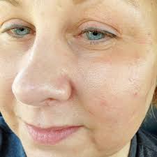 Revive Med Spa Reviews 2024