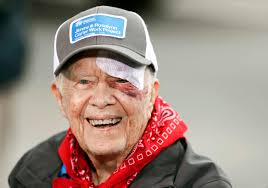 Despite 14 stitches and a black eye, Jimmy Carter is back building homes  alongside volunteers