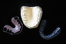 But for severe cases, it's a question of how long you are willing to do the treatment. You Have To Wear Your Retainer Just Had Your Braces Removed After Many By Bensonhurst Dental Forever Young Medium