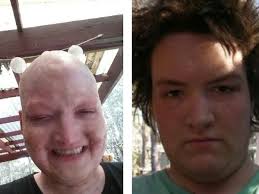 Fundraiser by Hamish McNally : Ham Ham wants to Live and Party on