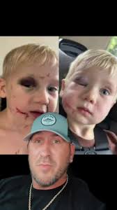 #stitch with @Kev_Eudy #fyp #daycare #protection #caring