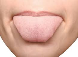 Como Evitar Esa Molesta Sequedad Bucal Prensa Libre