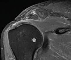 Image result for Shoulder Imaging