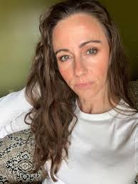 So last photo is the real me first 2 are the past 2 days! Anyone else  having swelling everywhere? I'm also experiencing severe joint pains with  the swelling. I can breath fine