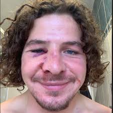 Radicalising the flock