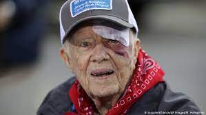Jimmy carter (formally james earl carter, jr., born 1924) was the 39th president of the united states of america, defeating republican gerald ford in 1976. Us Former President Jimmy Carter Admitted To Hospital For Brain Procedure Al Bilad English Daily