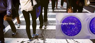 775,877 likes · 17,611 talking about this. Massive Proportion Of World S Population Are Living With Herpes Infection