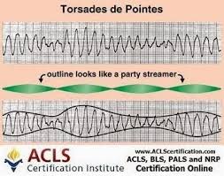Acls Certification Institute Google Emergency Nursing Pediatric Nursing Ventricular Tachycardia