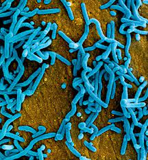 We did not find results for: Virus De Marburg