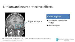 Depressed mood — feeling sad, empty, or tearful Lithium S Mechanism Of Action An Illustrated Review Psychopharmacology Institute