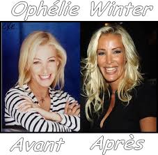 Ophélie winter avant et après chirurgie esthétique. Ophelie Winter Toutes Tes Stars Before After Leur