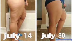 Taking a collagen supplement is supposed to improve the elasticity of your skin—in fact, a study published in skin pharmacology and physiology found that those who took collagen peptides once daily for eight weeks showed a significant improvement in skin's elasticity. Local Collagen Supplement Users Say It Helps Reduce Wrinkles Cellulite