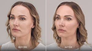 $50 off a syringe...