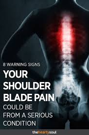 Pin On Back Exercises