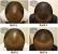 African American Receded Hairline Black Man