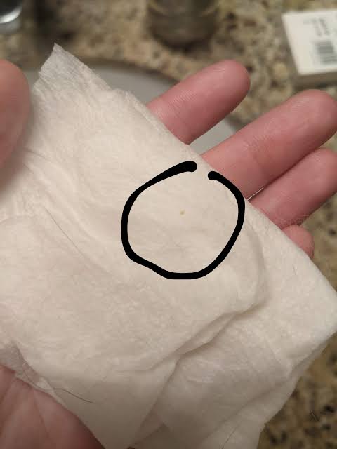 Checking specks on a damp paper towel to confirm flea dirt (Source: Reddit / r/catcare), AI generated