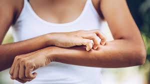 The cause of multiple sclerosis is unknown. When Multiple Sclerosis Causes Skin Symptoms Everyday Health