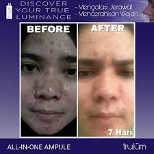 Tripadvisor has 240,056 reviews of tulum hotels, attractions, and restaurants making it your best tulum resource. Jual Trulum 15ml 5ml 120ml Obati Jerawat Jakarta Timur Trulum Anti Aging 1 Tokopedia