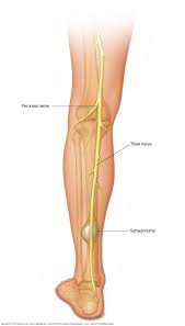 Some early cancers may have signs and symptoms that can be noticed, but that's not always the case. Peripheral Nerve Tumors Symptoms And Causes Mayo Clinic