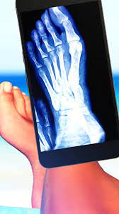 Possible causes, signs and symptoms, standard treatment options and means of care and support. X Ray Filter For Photos For Android Apk Download