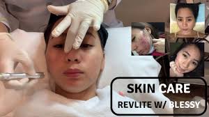 Its is used for skin reuvenation, skin lightening Laser Revlite Experience For My Acne Prone Skin Youtube