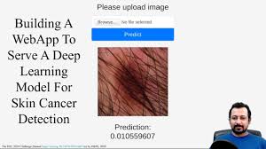 It may grow slowly and it's typically treatable. Build A Web App To Serve A Deep Learning Model For Skin Cancer Detection Youtube