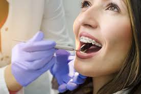 It can also be more or less. How Much Do Braces Actually Cost Orthodontics Of South Miami