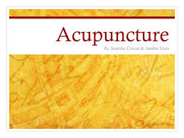Acupuncture By Jennifer Dixon Amber Hart Definition Of Acupuncture An Alternative Medicine That Treats Patients By Insertion And Manipulation Of Needles Ppt Download
