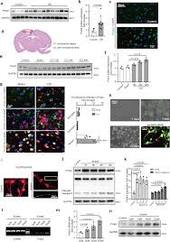 Maybe you would like to learn more about one of these? Prokineticin 2 Prevents Neuronal Cell Deaths In A Model Of Traumatic Brain Injury Nature Communications