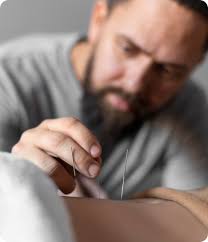 Welcome to Impact Dry Needling Clinic in Perth