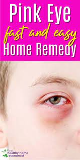 Pinkeye The Fastest And Easiest Home Remedy Pink Eyes Pink Eye Home Remedies Natural Pink Eye Remedy