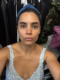 Hair spritz for cradle cap solution