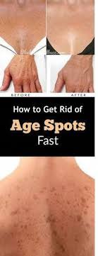 Daily I Live Happier Considering That Of This Remedy I Burn The Warts On My Skin Without Having Leav Age Spots On Face Brown Spots On Face Brown Spots On Skin