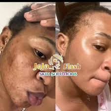 Black live Matter😭 why this treatment for black peoples😭😭