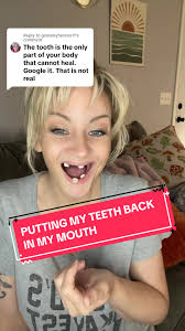 Denture Confidence: Putting Teeth Back In My Mouth