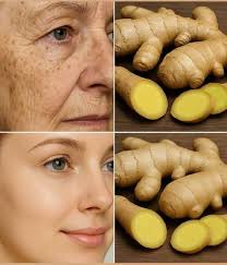 Ginger is 100 times more powerful than Botox in removing deep wrinkles,  freckles and dark spots. Recipe in (c.o.m.m.e.n.t ).