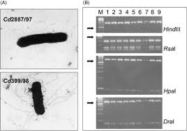 This genus includes several significant human pathogens, including the causative agents of botulism and tetanus. Variable Flagella Expression Among Clonal Toxin A B Clostridium Difficile Strains With Highly Homogeneous Flagellin Genes Clinical Microbiology And Infection
