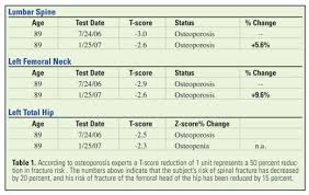 bone weight chart qmsdnug org