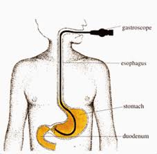 And, fewer people in the u.s. Gastric Cancer Physiopedia