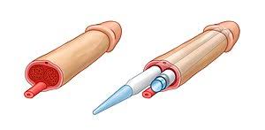 Jul 02, 2021 · tiago, da dupla com hugo, se submeterá à cirurgia de aumento peniano. Faloplastia Wikipedia La Enciclopedia Libre